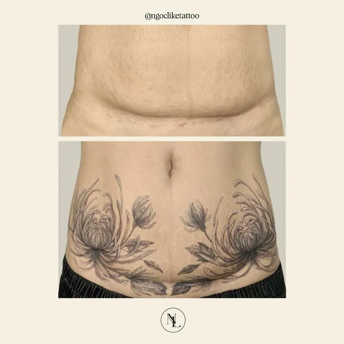 40 Personas que querían tapar sus cicatrices, y esta tatuadora lo consiguió (nuevas fotos)