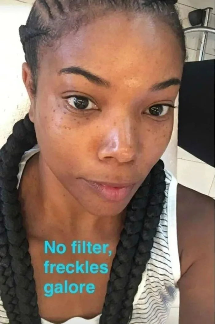 When Gabrielle Union Turned To Her Front-Facing Camera To Show Off Her "Freckles Galore"