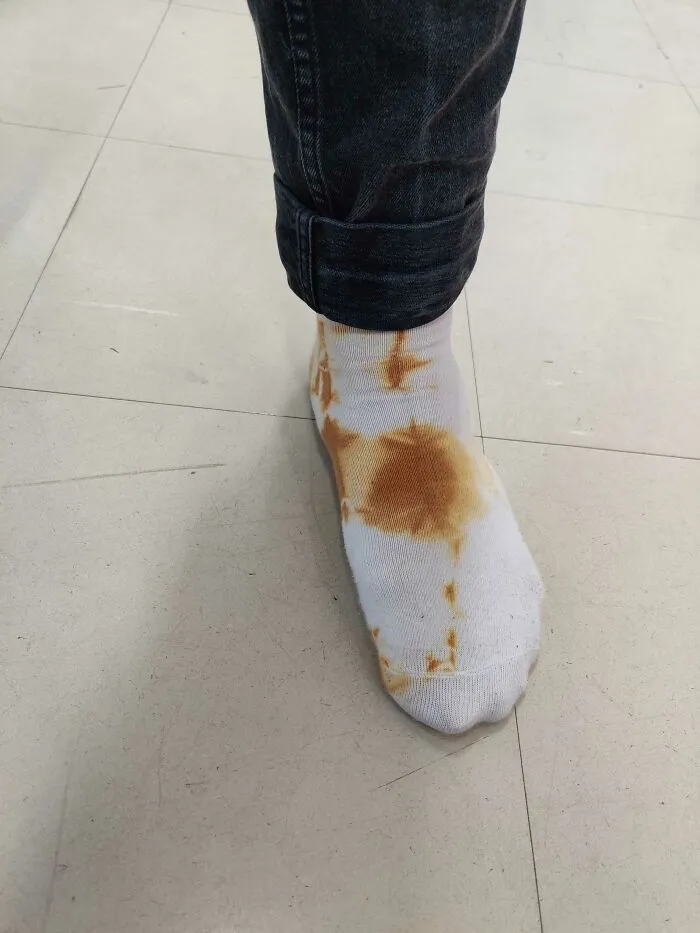 Unos calcetines teñidos que parecen haber sido usados como papel higiénico  