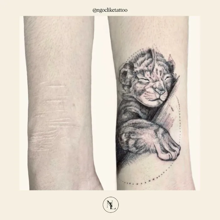 50 Times People Asked To Cover Up Their Scars, And This Tattoo Artist Nailed It (New Pics)