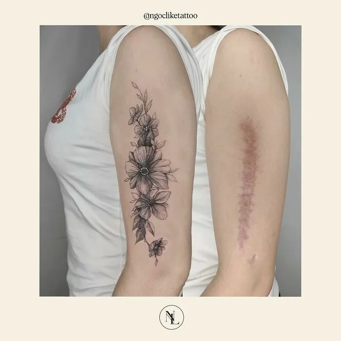 50 Times People Asked To Cover Up Their Scars, And This Tattoo Artist Nailed It (New Pics)