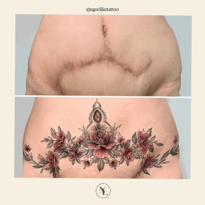 40 Personas que querían tapar sus cicatrices, y esta tatuadora lo consiguió (nuevas fotos)