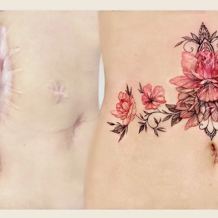 40 Personas que querían tapar sus cicatrices, y esta tatuadora lo consiguió (nuevas fotos)