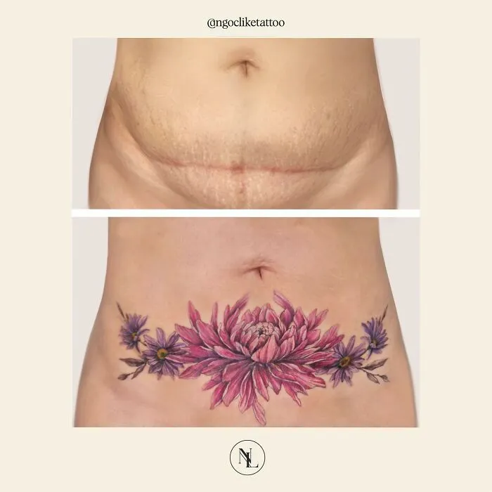 40 Personas que querían tapar sus cicatrices, y esta tatuadora lo consiguió (nuevas fotos)