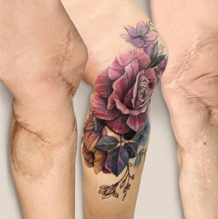 40 Personas que querían tapar sus cicatrices, y esta tatuadora lo consiguió (nuevas fotos)