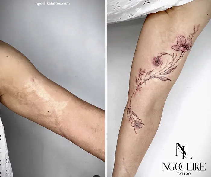 40 Personas que querían tapar sus cicatrices, y esta tatuadora lo consiguió (nuevas fotos)