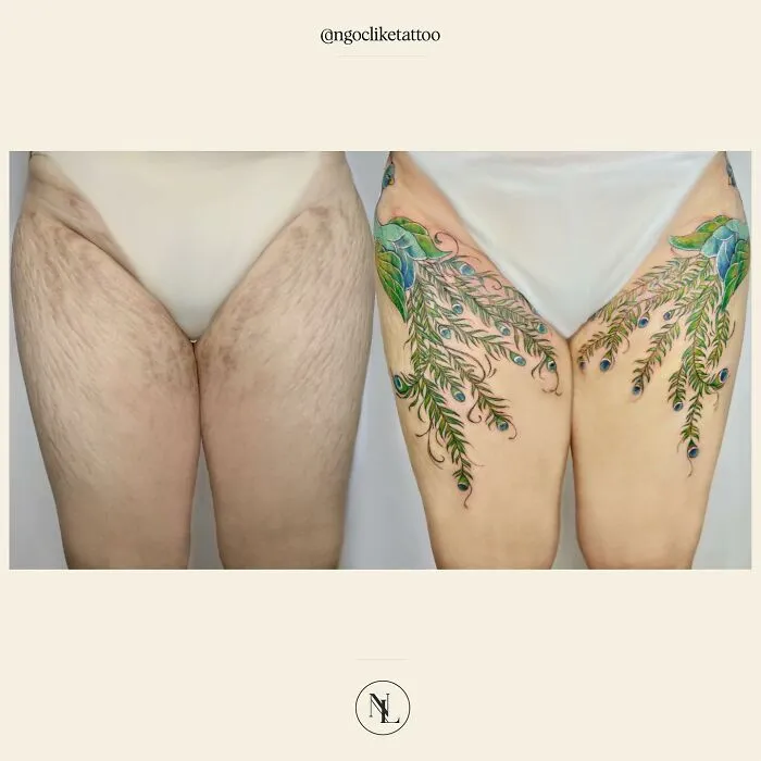 50 Times People Asked To Cover Up Their Scars, And This Tattoo Artist Nailed It (New Pics)