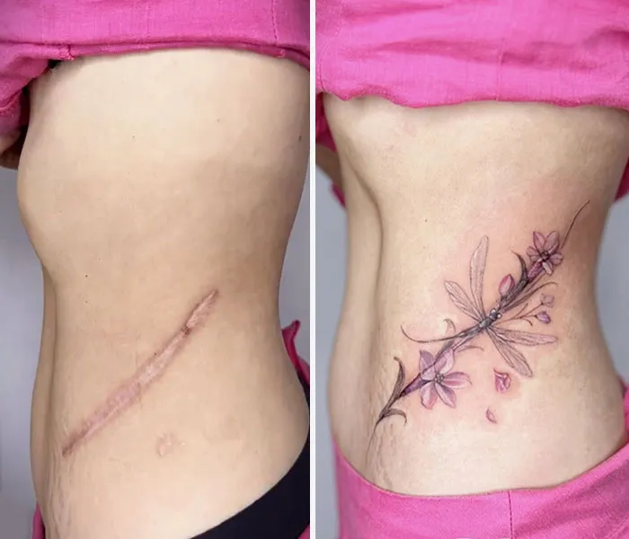 40 Personas que querían tapar sus cicatrices, y esta tatuadora lo consiguió (nuevas fotos)
