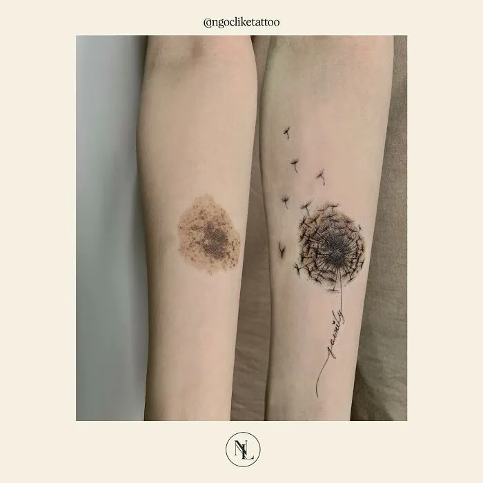 50 Times People Asked To Cover Up Their Scars, And This Tattoo Artist Nailed It (New Pics)