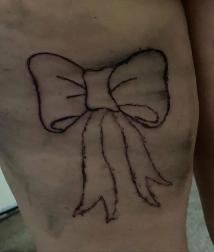 Poorly drawn bow tattoo on skin, shared by a Facebook group highlighting bad tattoos.