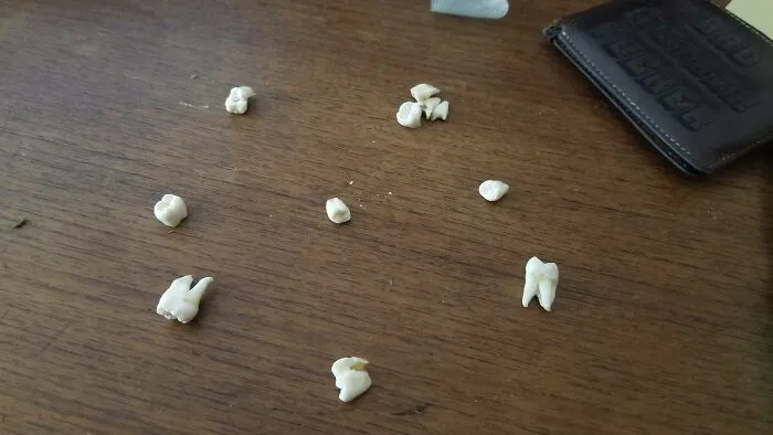 People Who Experienced "One-In-A-Million" Situations Share Their Fascinating Stories