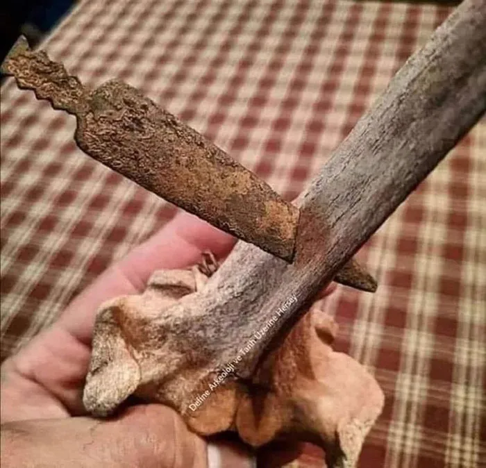 This Is How The Head Of A Spear Went Through A Bone During The Roman Gallic Wars. It Still Remains In The Bone After 2070 Years