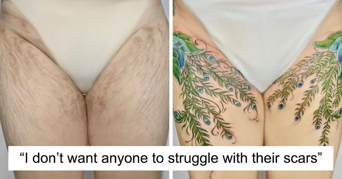 50 Times People Asked To Cover Up Their Scars, And This Tattoo Artist Nailed It (New Pics)