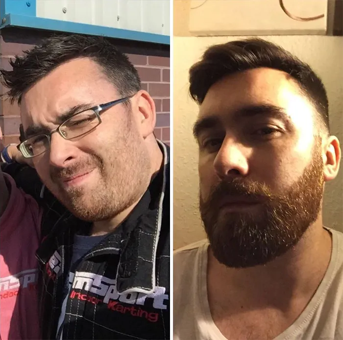 3 Months Before/After