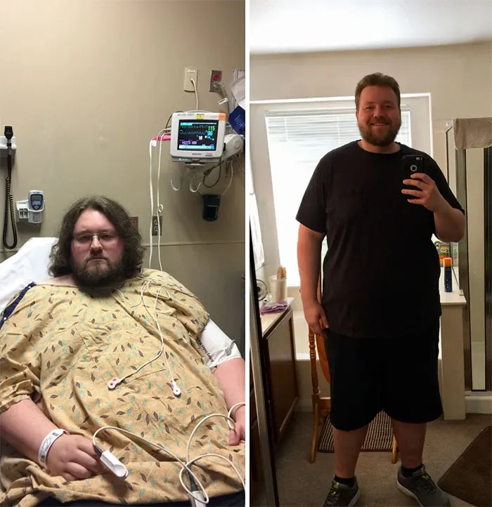 Still Far From Where I Want To Be But Taking It Off Little By Little. Lots Of UPS And Downs Along The Way Using Cico And The Gym