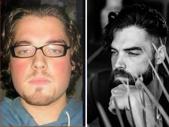Lost Weight, Grew Beard And Started Doing Modeling In My 30s. Not Much Success But Is Nice To Be Skinny And Relatively Fit