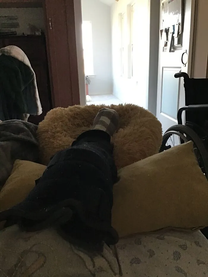 Well … Actually I Got This On My Birthday (But Only Days From Christmas)) - A Badly Broken Leg