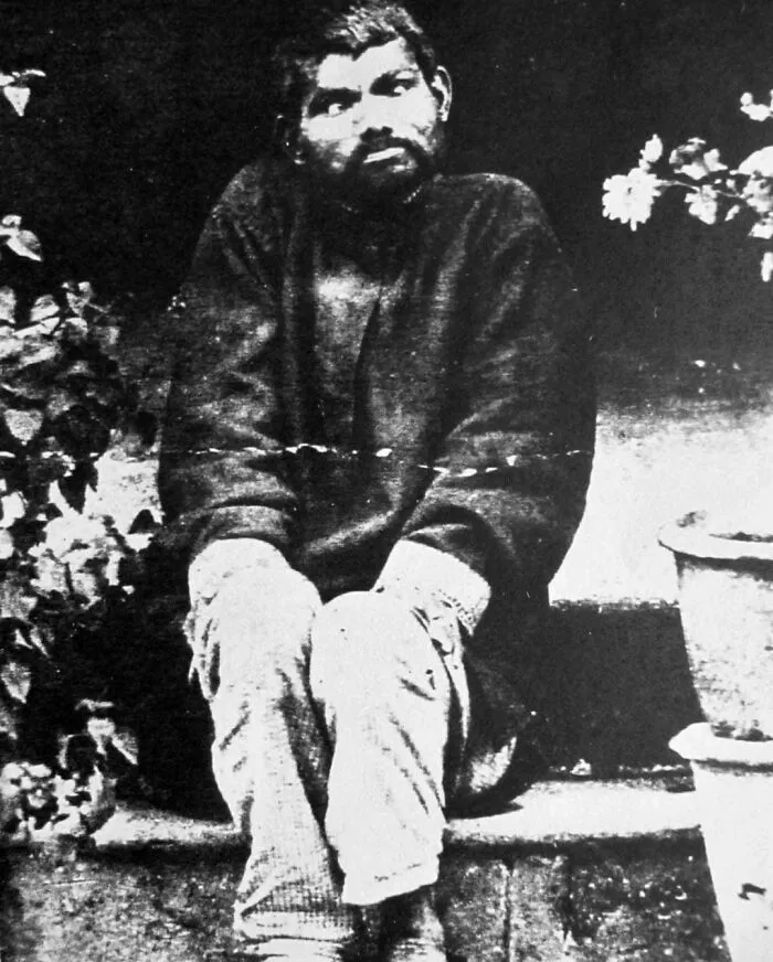 The Man In The Picture Is Dina Sanichar, Widely Believed To Be Raised By The Wolves