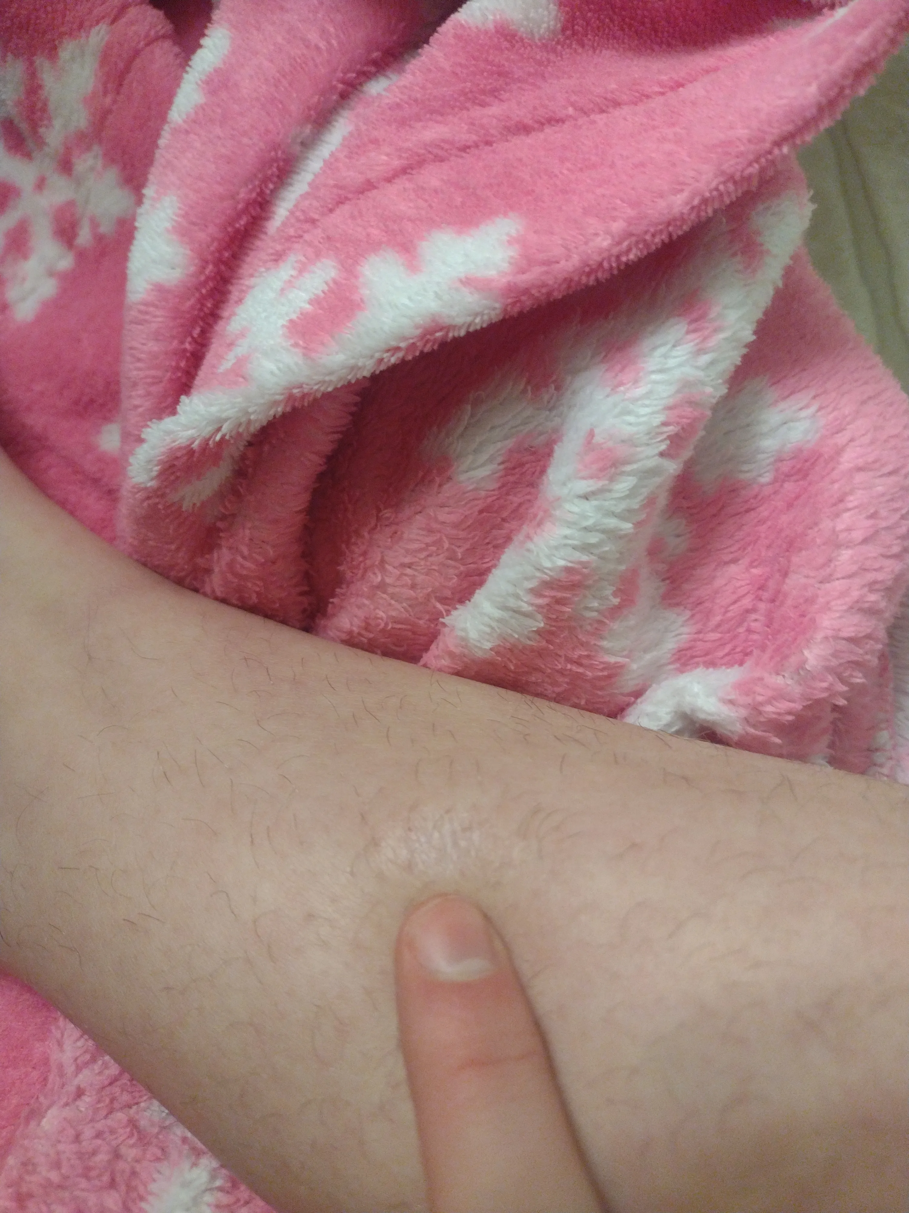 Show Me Your Scars With The Funniest Story's