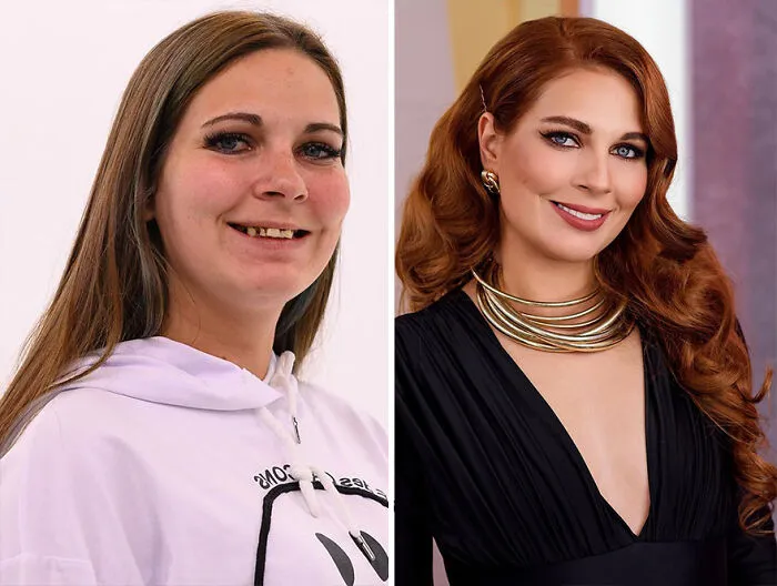 TV Show Gives People An Extreme Makeover, Here Are 52 Of The Best Before-And-After Pics