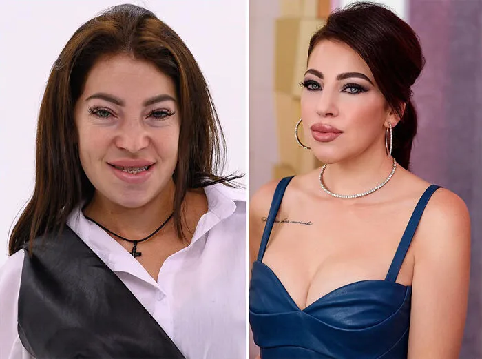 TV Show Gives People An Extreme Makeover, Here Are 52 Of The Best Before-And-After Pics