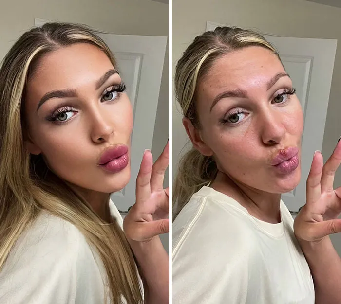 Esta mujer editó sus fotos exageradamente para demostrar la falsedad de lo que vemos en redes sociales (nuevas imágenes)