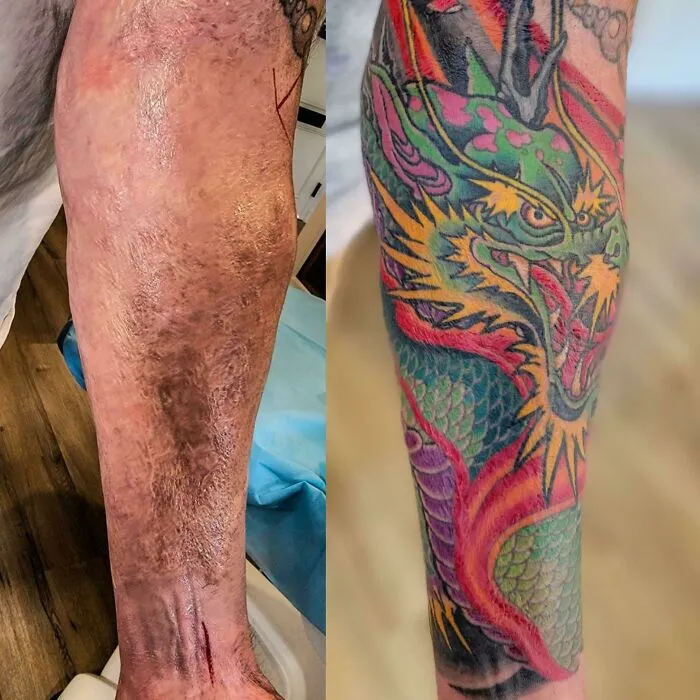 He cubierto algunas cicatrices de quemaduras de tercer grado con un dragón de fuego de Adam Sky, Morningstar Tattoo, Belmont, California