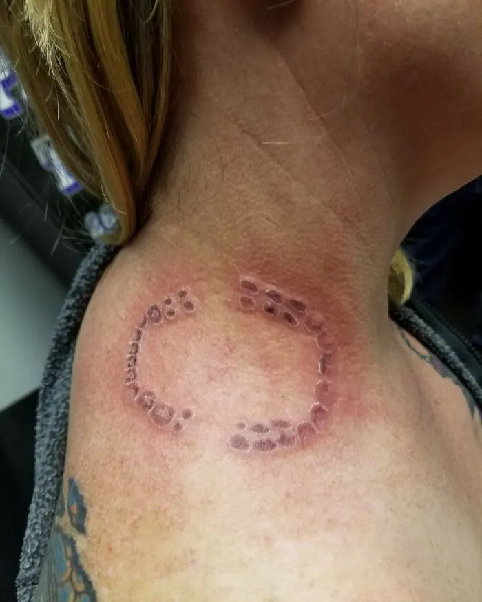 Esta mujer quería tatuarse la mordedura de su marido
