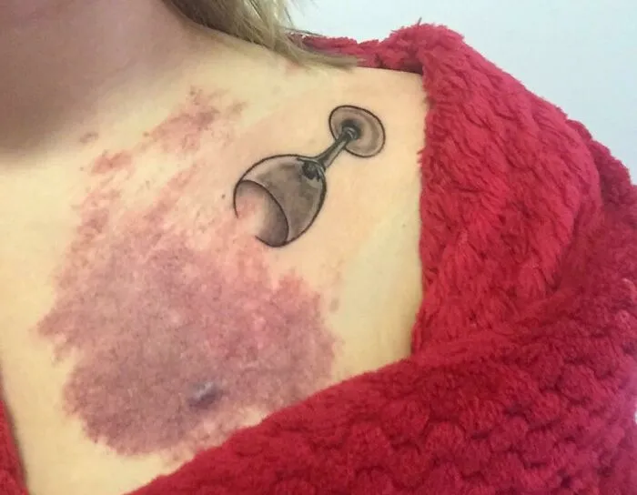 Now My Birth Mark Is An Actual Wine Stain