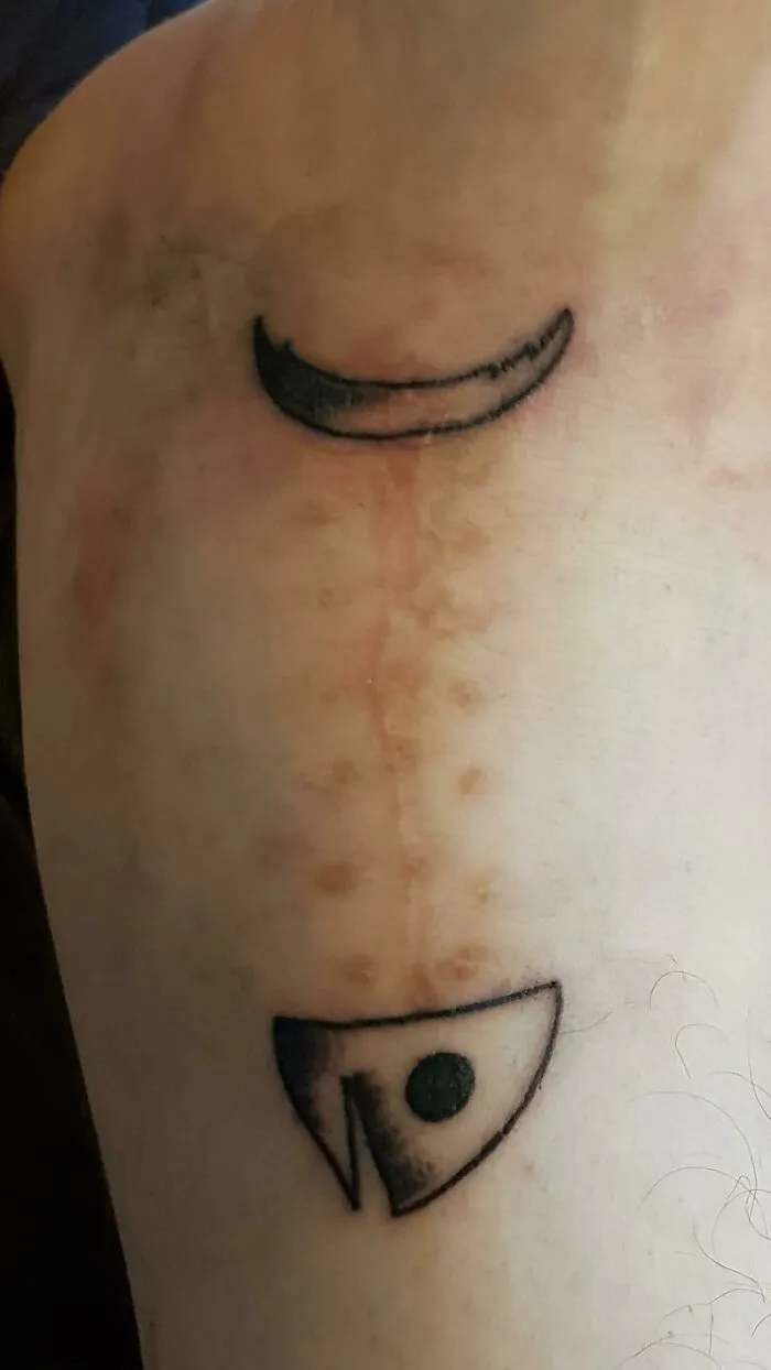 I Have Had Multiple Ankle Surgeries. Today I Got A Tattoo To Make My Scar A Little Sillier