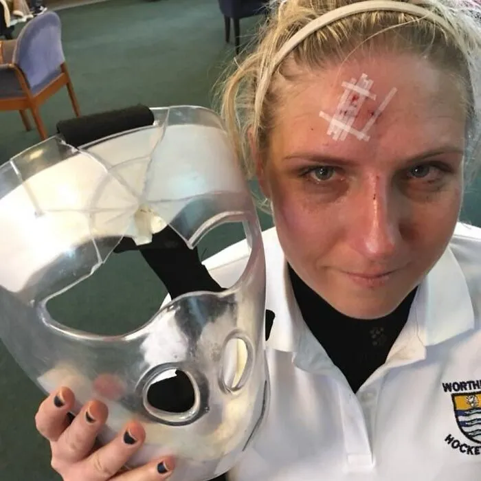 This Is Why Hockey Players Wear Masks