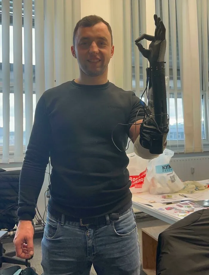 Last Weekend We Began Delivering 3D Printed Bionic Hands To Ukraine! First Up, A 24 Year Old Soldier