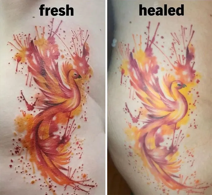 Fresh Vs. 1 Year Healed, On My Right Hip