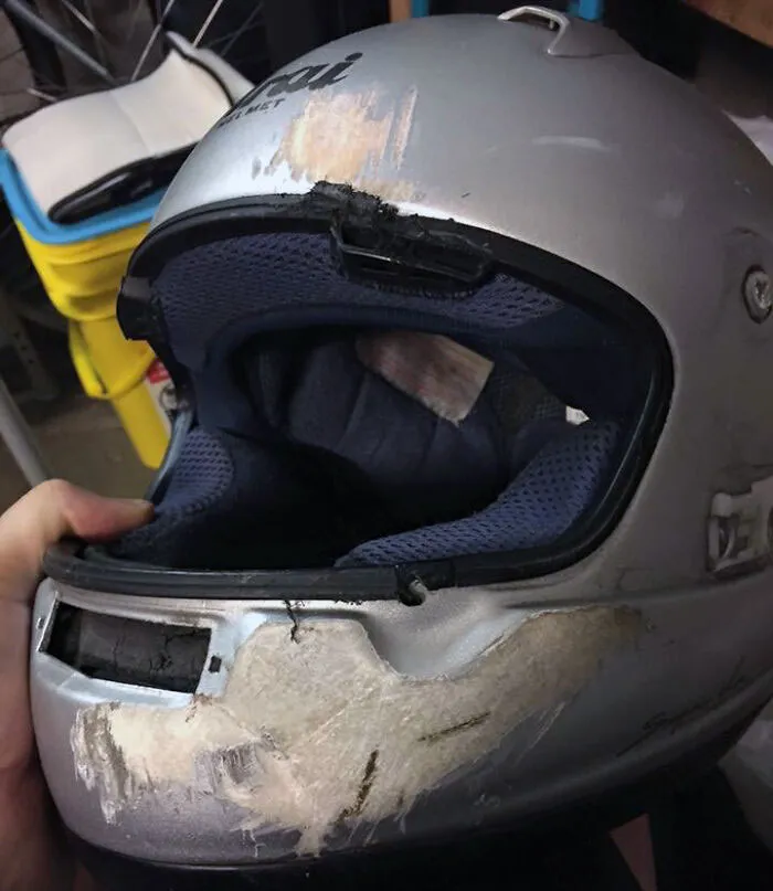 Por eso debes llevar casco completo. Mi amigo fue atropellado por alguien que se saltó un semáforo en rojo. Si hubiera llevado un casco sencillo, no tendría mandíbula inferior