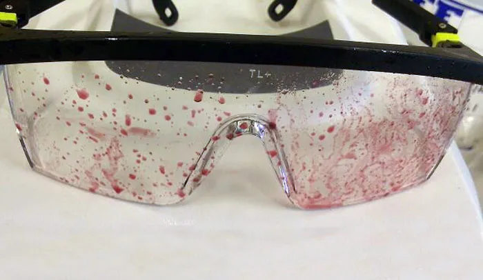 Seriously, Proper Lab Attire Saved Me From Certain Blindness