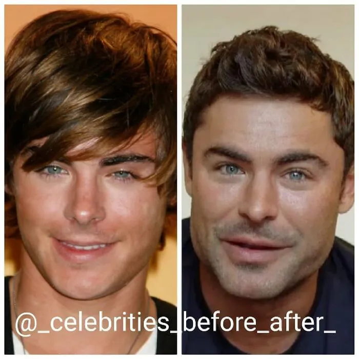 Zac Efron