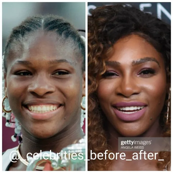 Serena Williams