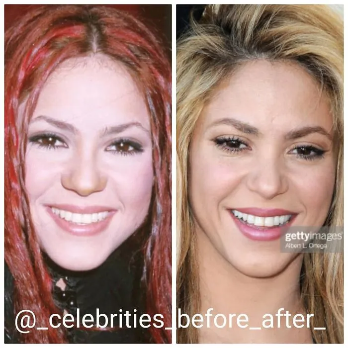 Shakira