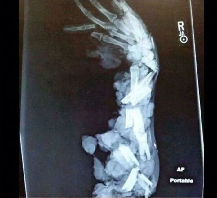 Cursed_xray