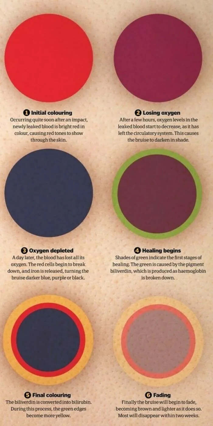 The Bruise Spectrum