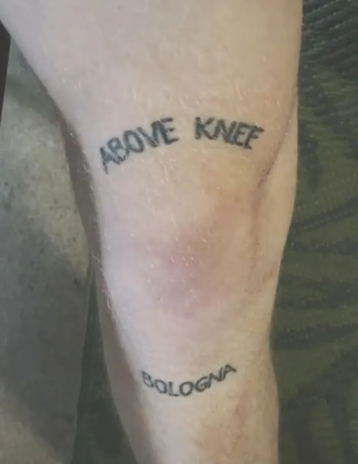 This Pun-Knee Joke