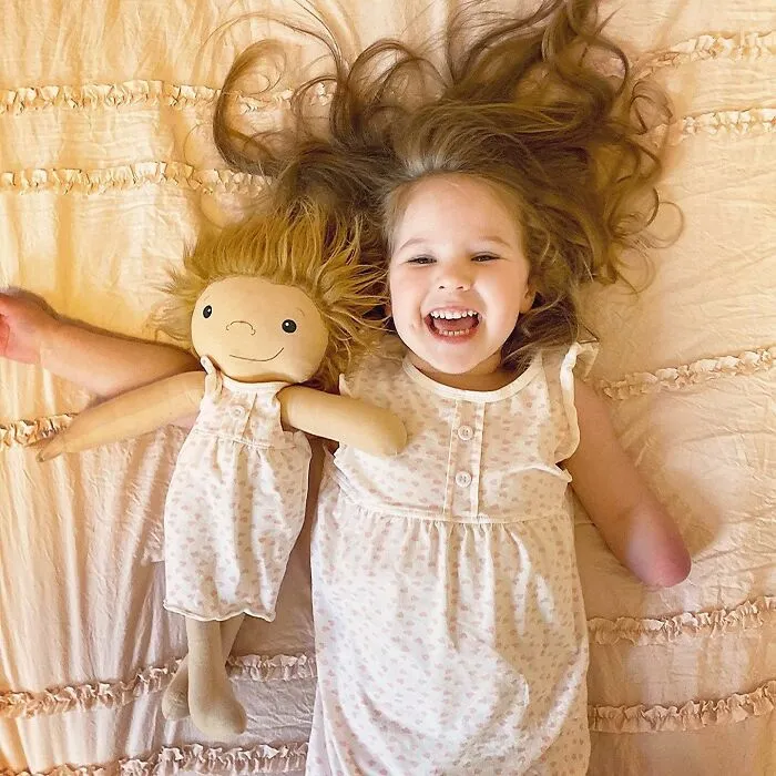 A smiling girl with a custom doll lying on a bed, both featuring similar arm differences, representing themselves.
