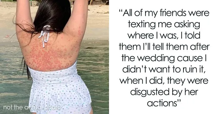 Woman Leaves "Friend's" Wedding After She's Called Out For Not Covering Up Her Skin Condition