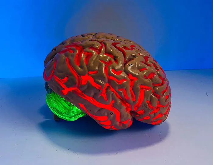 Picture of human brain mullage