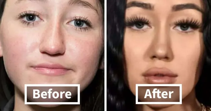 This Instagram Account Shares Before-After Pics Of Some Celebrities And The Transformations Might Surprise You (35 New Pics)