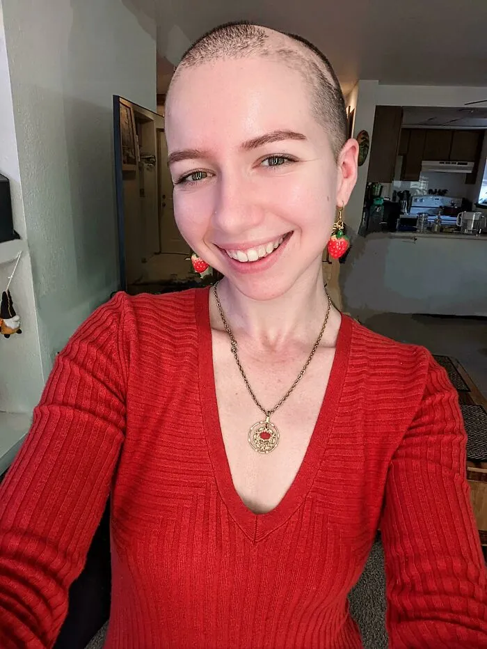 Ya no tomo el medicamento contra la alopecia aprobado por la FDA debido a sus graves efectos secundarios. He decidido aceptar plenamente el hecho de que voy a ser una princesa con parches en la cabeza y estoy bien con eso