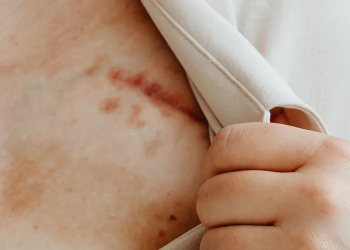 35 Psychiatric Hospital Employees And Patients Share The Creepiest And Most Disturbing Things They’ve Witnessed