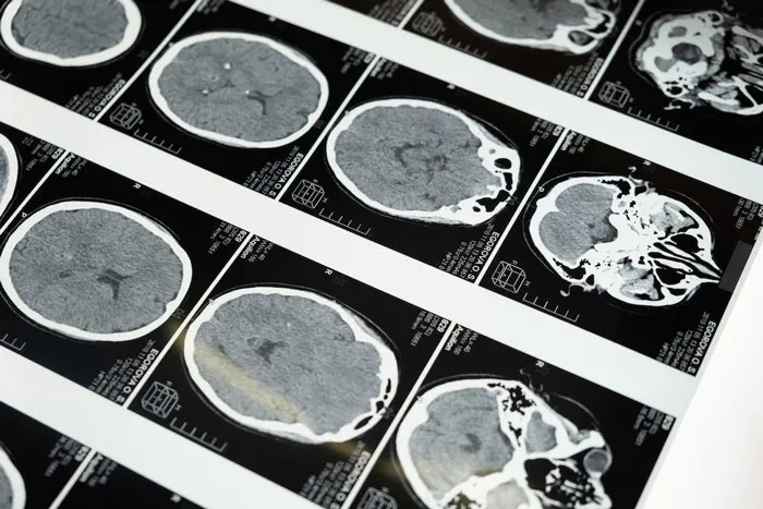 People Share 40 Creepy Things That They Wish Were Lies But Are Actually Scientific Facts