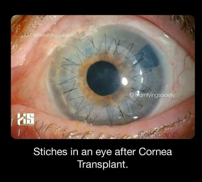 40 Creepy Facts Not For The Fainthearted, As Shared On The "Terrifying Society" Instagram Page