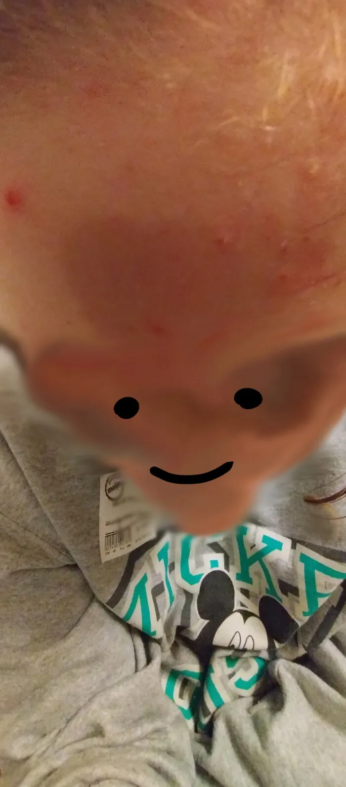 I Blurred Out And Smudged My Face Bc I'm A Minor Lol
